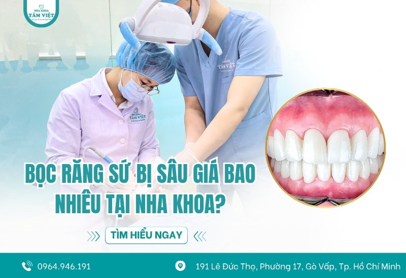 Bọc răng sứ bị sâu giá bao nhiêu tại nha khoa? Có đắt không?