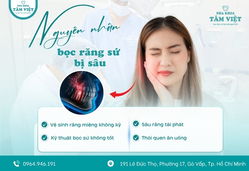 Bọc răng sứ bị sâu giá bao nhiêu tại nha khoa? Có đắt không? 2 Nguyên nhân răng đã bọc sứ bị sâu