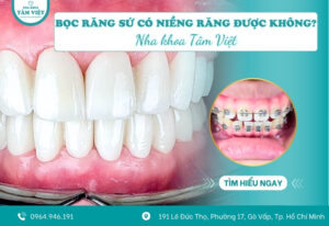Sau bọc răng sứ có niềng răng được không?