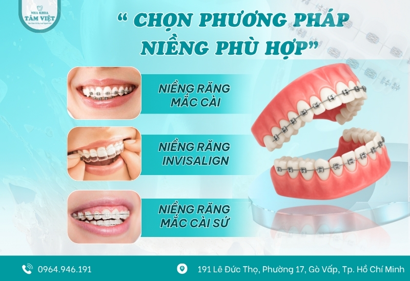 Những phương pháp niềng phù hợp