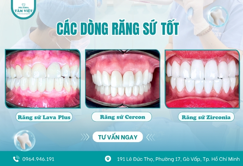 Bọc răng sứ lần 2 khi nào? Thực hiện ra sao? 3 Nâng cấp các dòng răng sứ tốt hơn