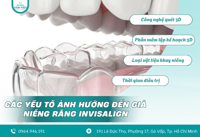 Cập nhật chi phí niềng răng Invisalign tại nha khoa hiện nay 3 Các yếu tố ảnh hưởng đến giá niềng răng Invisalign