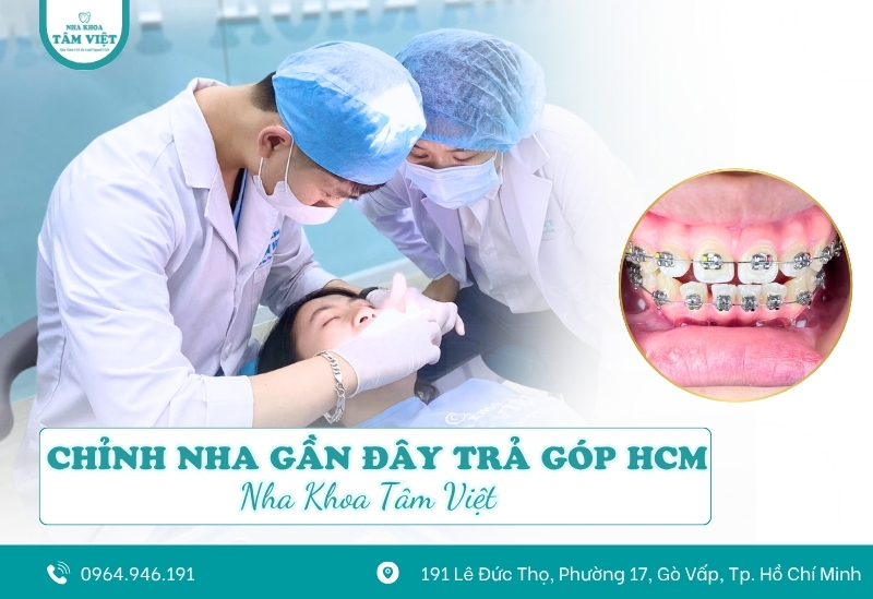 Địa chỉ chỉnh nha gần đây trả góp HCM có bảo hành