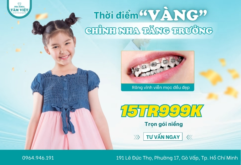 Địa chỉ niềng răng uy tín, hiệu quả tại TPHCM bạn nên biết 5 Chương trình ưu đãi đặc biệt trong tháng 5