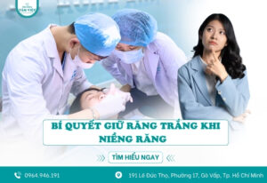 Bí quyết giữ răng trắng khi niềng răng có thể bạn chưa biết