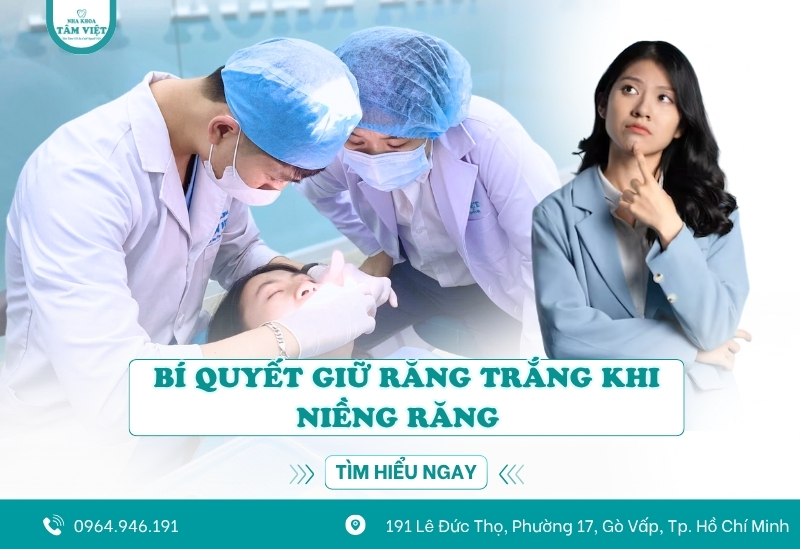 Bí quyết giữ răng trắng khi niềng răng có thể bạn chưa biết