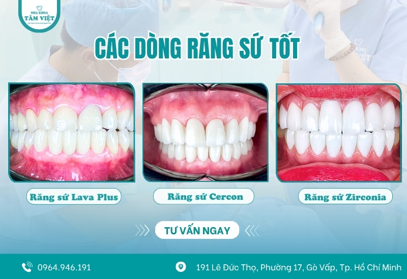 Nha khoa bọc sứ giá rẻ Gò Vấp với chất lượng vượt trội 3 Răng sứ toàn sứ