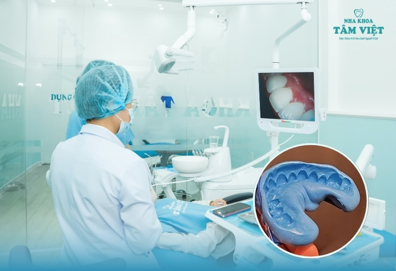 Nha khoa bọc sứ giá rẻ Gò Vấp với chất lượng vượt trội 4 Lấy dấu răng và chế tạo răng sứ