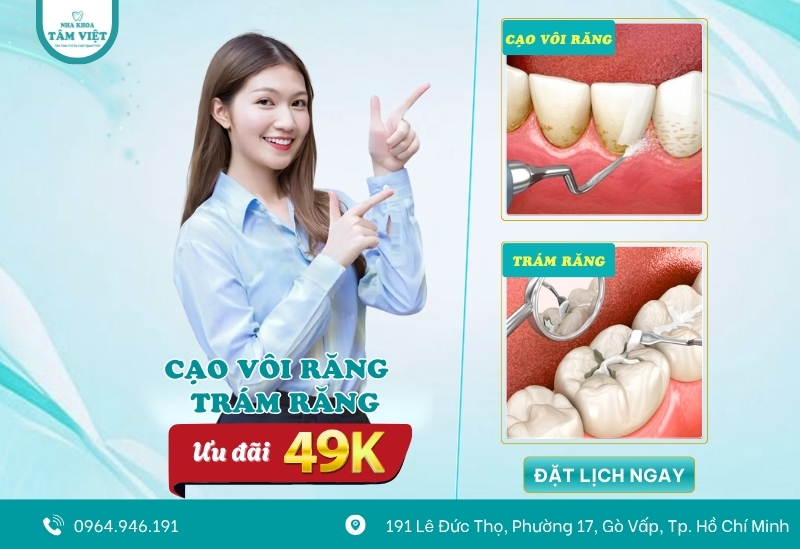 Nha khoa lấy cao răng Gò Vấp nào uy tín, an toàn, hiệu quả? 5 Ưu đãi cạo vôi răng chỉ từ 49k tại nha khoa