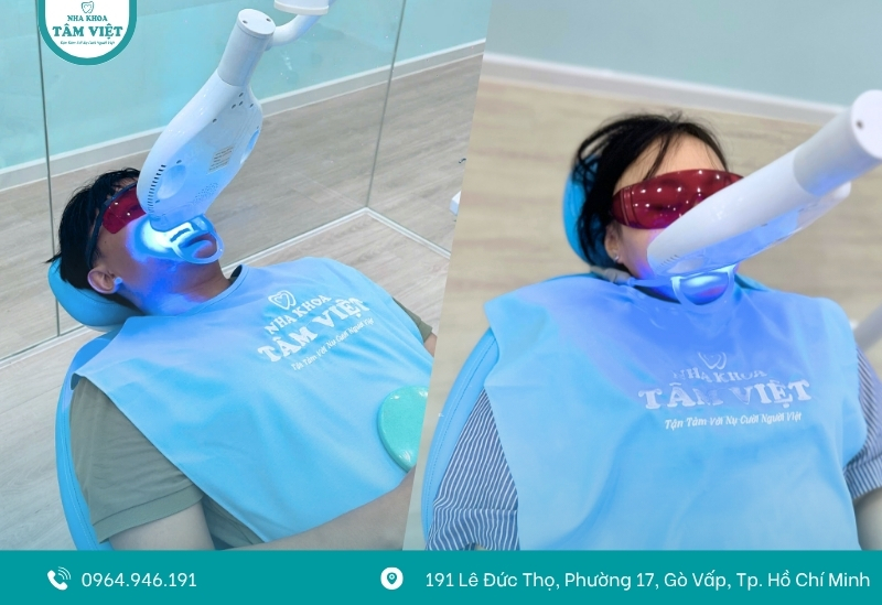 Tìm nha khoa tẩy trắng răng gần đây uy tín tại TPHCM 5 Bao lâu tẩy trắng răng 1 lần?