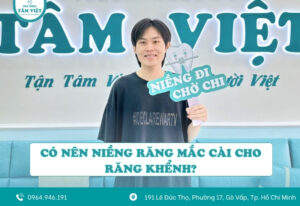 Có nên niềng răng mắc cài cho răng khểnh?
