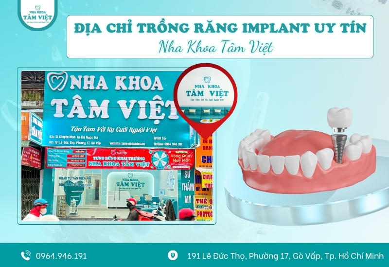 Phòng khám trồng răng implant không đau, an toàn tuyệt đối 3 Nha khoa Tâm Việt – Lựa chọn nổi bật cho dịch vụ phòng khám trồng răng implant không đau