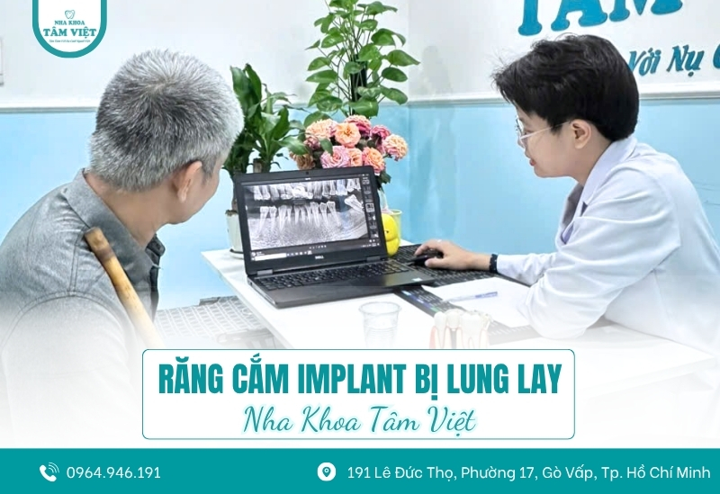 Răng cắm implant bị lung lay, phải làm gì?