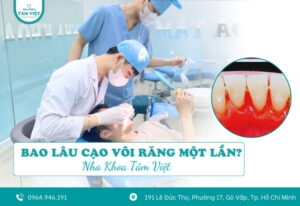 Bao lâu cạo vôi răng 1 lần là tốt nhất?