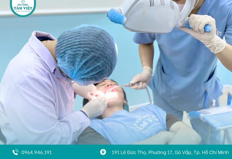 Bao lâu cạo vôi răng 1 lần là tốt nhất? 4 Dấu hiệu cho thấy bạn cần đi lấy cao răng
