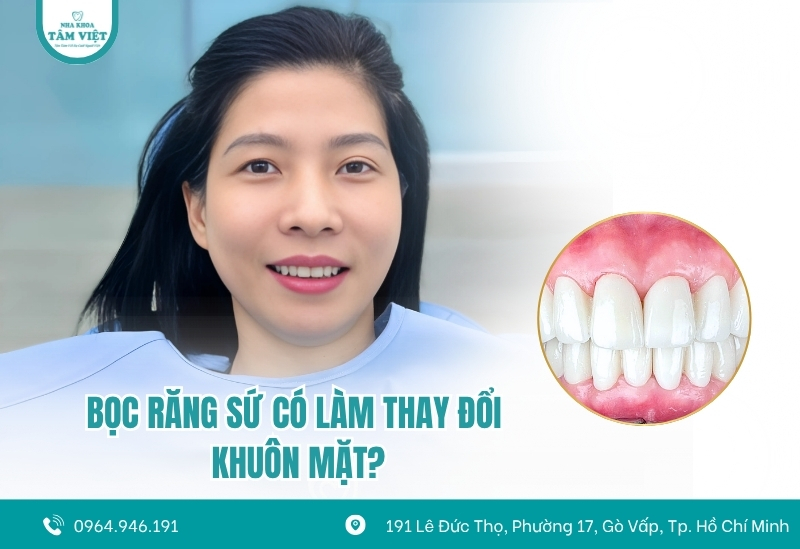 Bọc răng sứ có làm thay đổi khuôn mặt không?