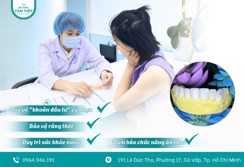 Hướng dẫn chăm sóc răng sau làm răng sứ đúng chuẩn 2 Tầm quan trọng của việc chăm sóc răng sứ