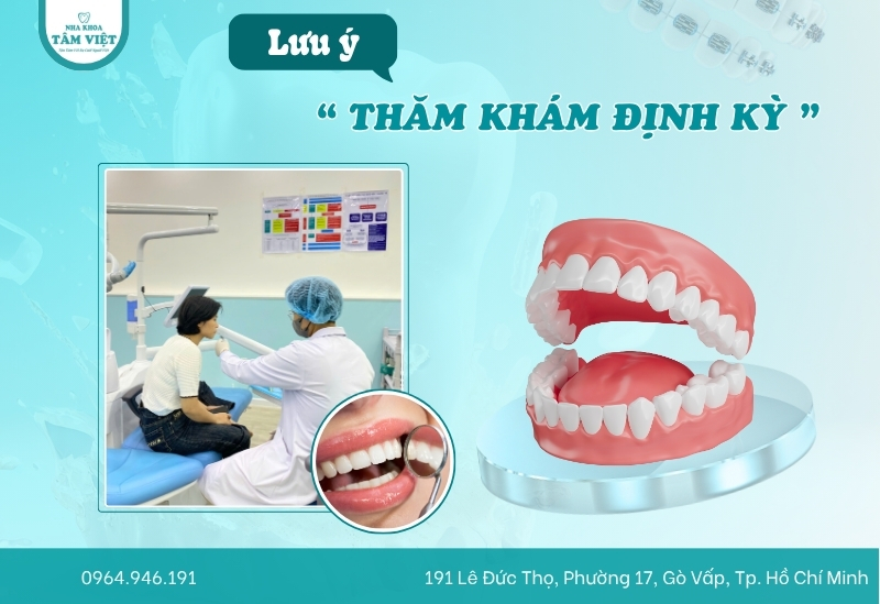 Hướng dẫn chăm sóc răng sau làm răng sứ đúng chuẩn 4 Thăm khám 6 tháng/lần tại nha khoa làm răng sứ uy tín