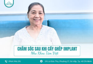 Chăm sóc sau khi cấy ghép Implant đúng cách và an toàn