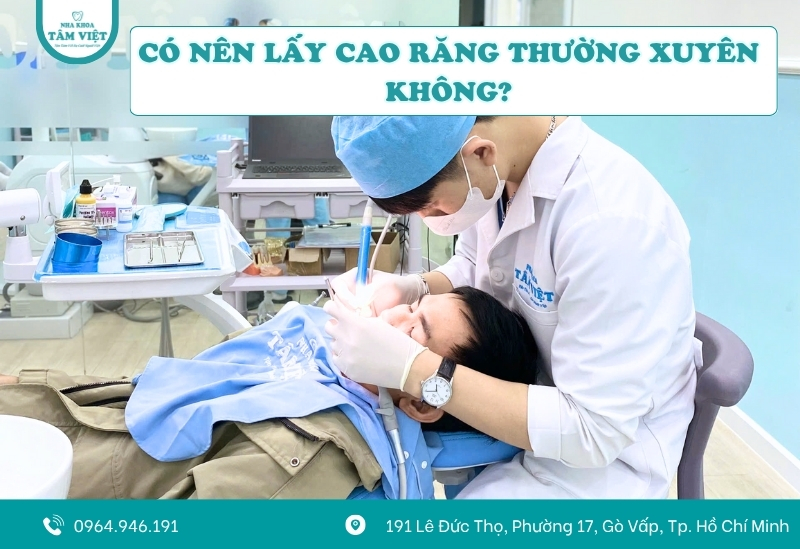 Có nên lấy cao răng thường xuyên không? Bao lâu lấy 1 lần?