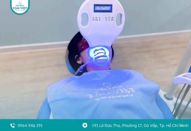 Quy trình tẩy trắng răng tại Tâm Việt