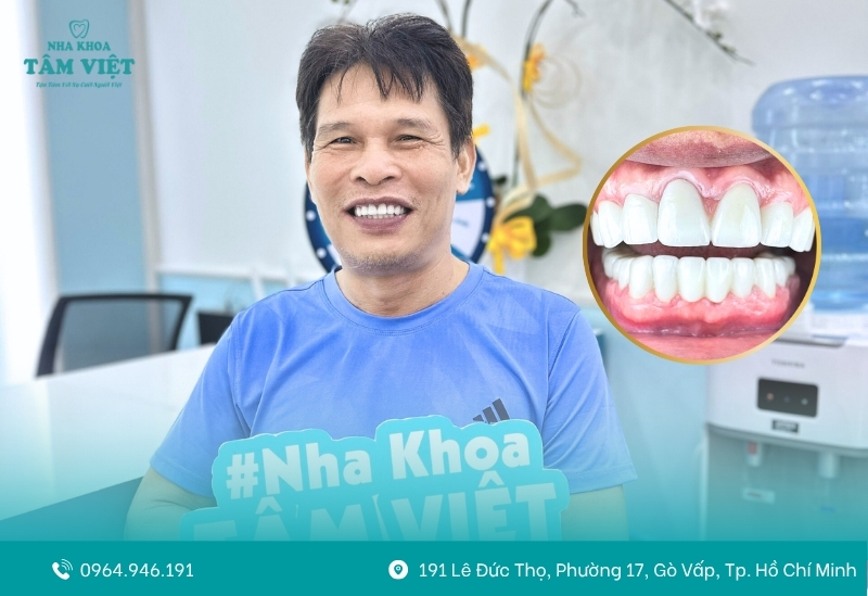 Mài răng bọc sứ có đau không? Có ảnh hưởng gì không? 4 Cảnh giác cảm giác đau nhức