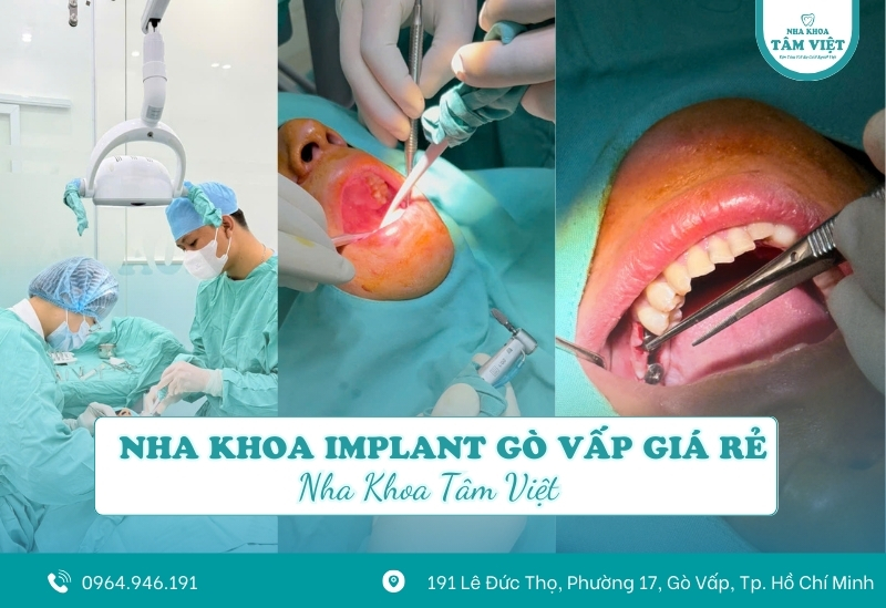 Đâu là nha khoa Implant Gò Vấp giá rẻ, chất lượng?