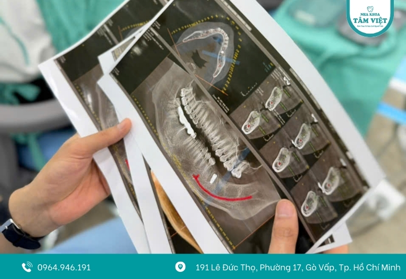 Đâu là nha khoa Implant Gò Vấp giá rẻ, chất lượng? 3 Sử dụng thiết bị hiện đại