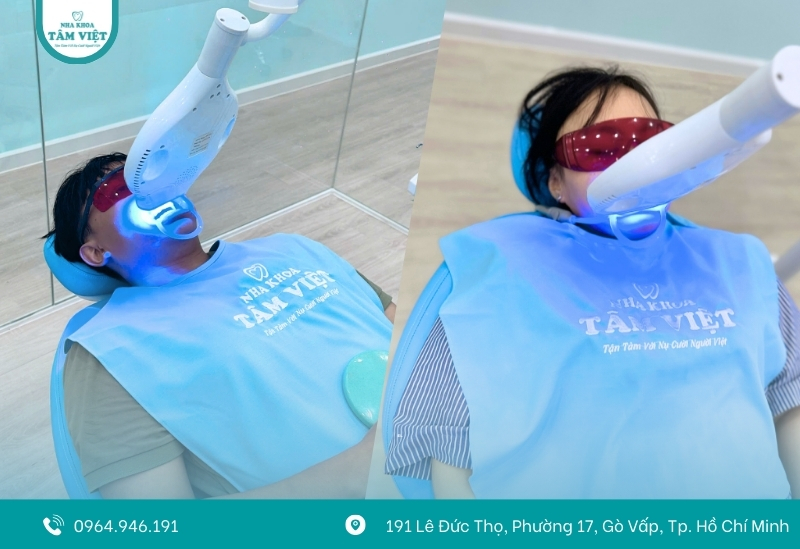 Tẩy trắng răng bằng Laser Whitening