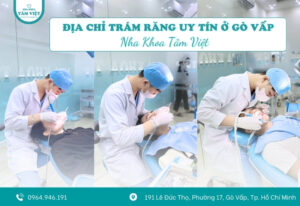 Địa chỉ trám răng uy tín ở Gò Vấp được đánh giá cao