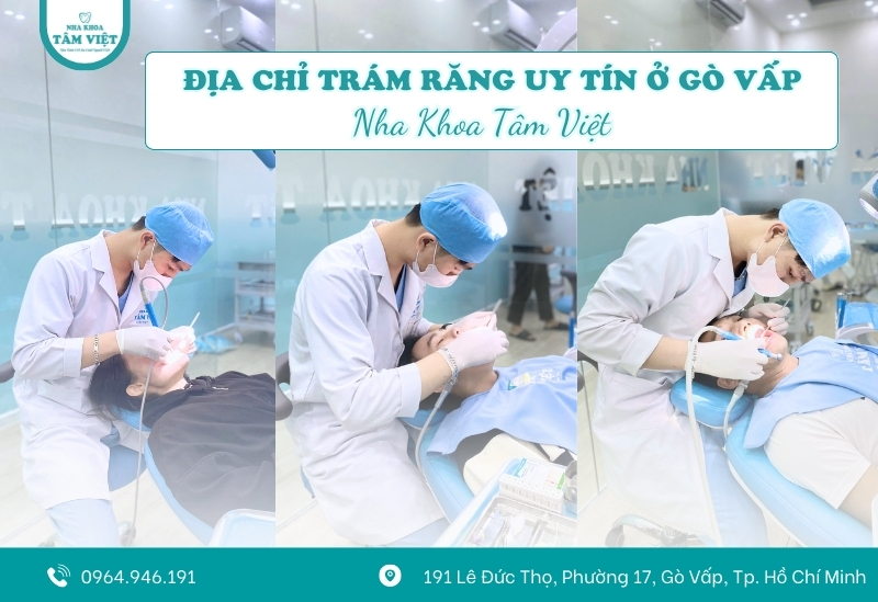 Địa chỉ trám răng uy tín ở Gò Vấp được đánh giá cao