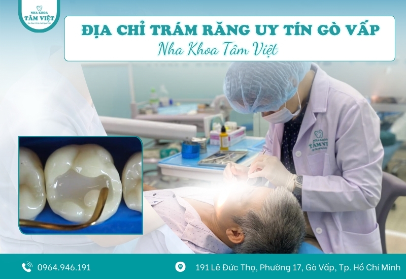 Địa chỉ trám răng uy tín ở Gò Vấp được đánh giá cao 5 Tâm Việt là lựa chọn trám răng uy tín ở Gò Vấp