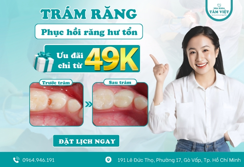Địa chỉ trám răng uy tín ở Gò Vấp được đánh giá cao 6 Ưu đãi Hè rạng rỡ – trám răng thẩm mỹ chỉ 49K