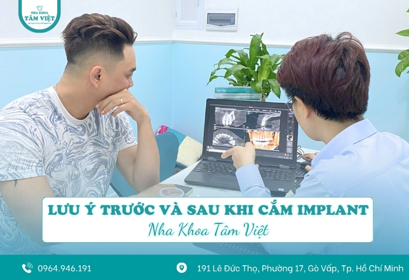 Lưu ý quan trọng trước và sau khi trồng răng implant