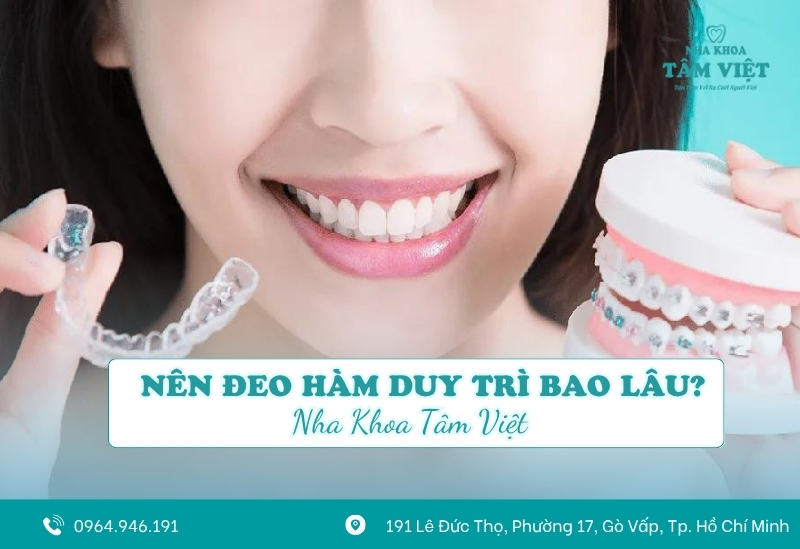 Nên đeo hàm duy trì bao lâu sau khi tháo niềng?