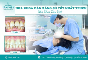 Review nha khoa dán răng sứ tốt nhất TPHCM hiện nay