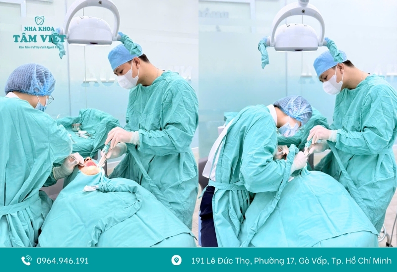 Đâu là nha khoa implant uy tín HCM đáng tin cậy? 4 Quy trình Implant an toàn, khép kín