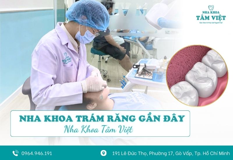 Nha khoa trám răng gần đây chất lượng, chi phí rẻ