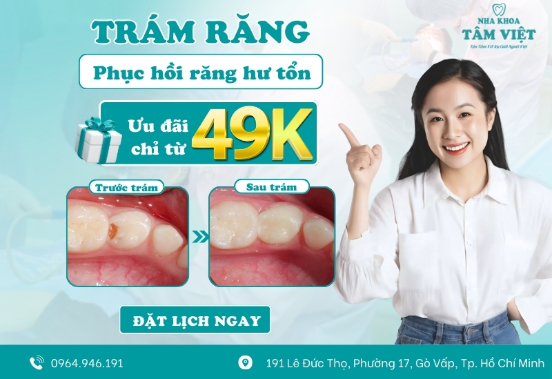 Nha khoa trám răng gần đây chất lượng, chi phí rẻ 6 Trám răng thẩm mỹ chỉ từ 49.000đ