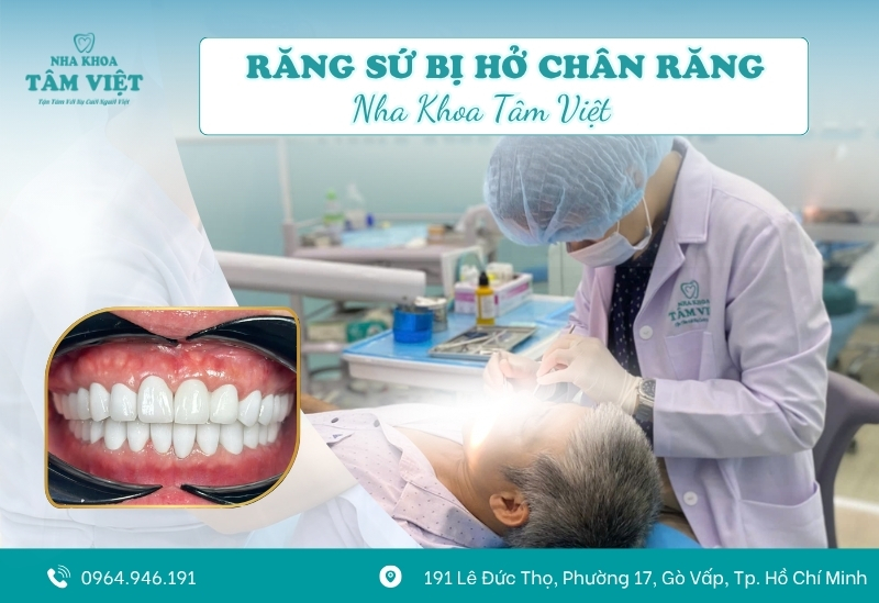 Bọc răng sứ bị hở chân răng phải xử lý như thế nào?