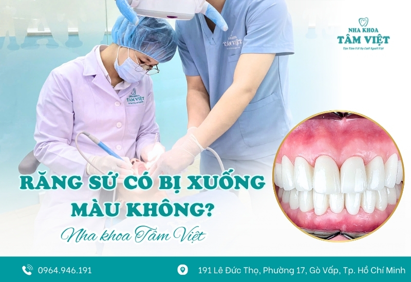 Răng sứ có bị xuống màu theo thời gian không?