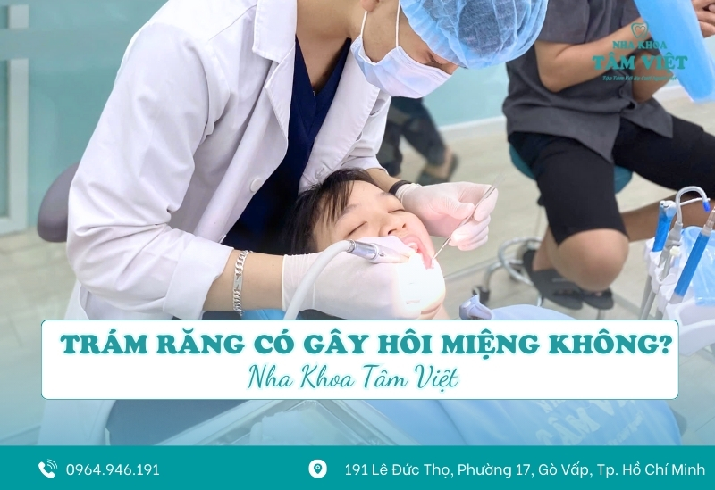 [Giải đáp] Trám răng có gây hôi miệng không?
