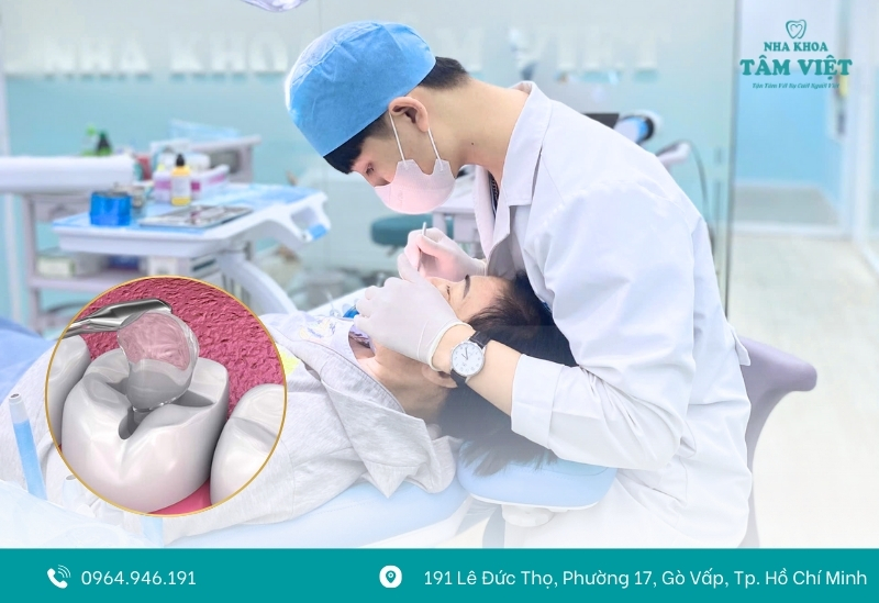 Kẽ hở ở miếng trám là nơi vi khuẩn và thức ăn gây mùi tích tụ