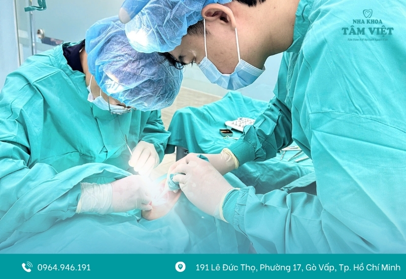 Trồng răng implant all on 4 là gì? Giá bao nhiêu? 4 Quy trình trồng răng Implant All on 4
