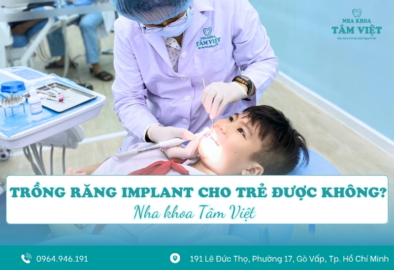 Trồng răng implant cho trẻ được không? Cần lưu ý gì?