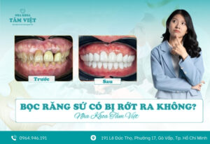 Bọc răng sứ có bị rớt ra không? Cách khắc phục