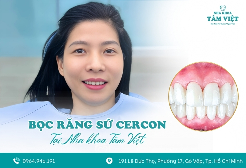 Bọc răng sứ có bị rớt ra không?