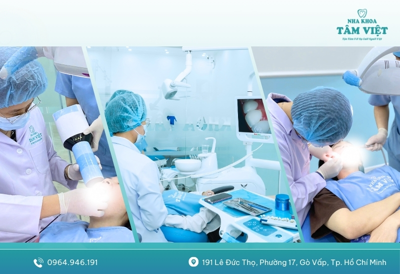 Công nghệ Smile Design 3D tiên tiến
