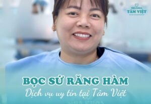 bọc sứ răng hàm bị sâu