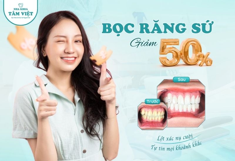 Bọc sứ thẩm mỹ giảm 50%